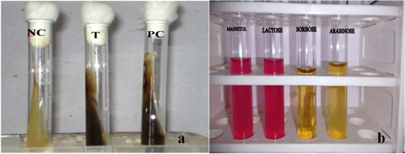 A paradigm shift in Enterococcal infections: A cause of concern-IJMR