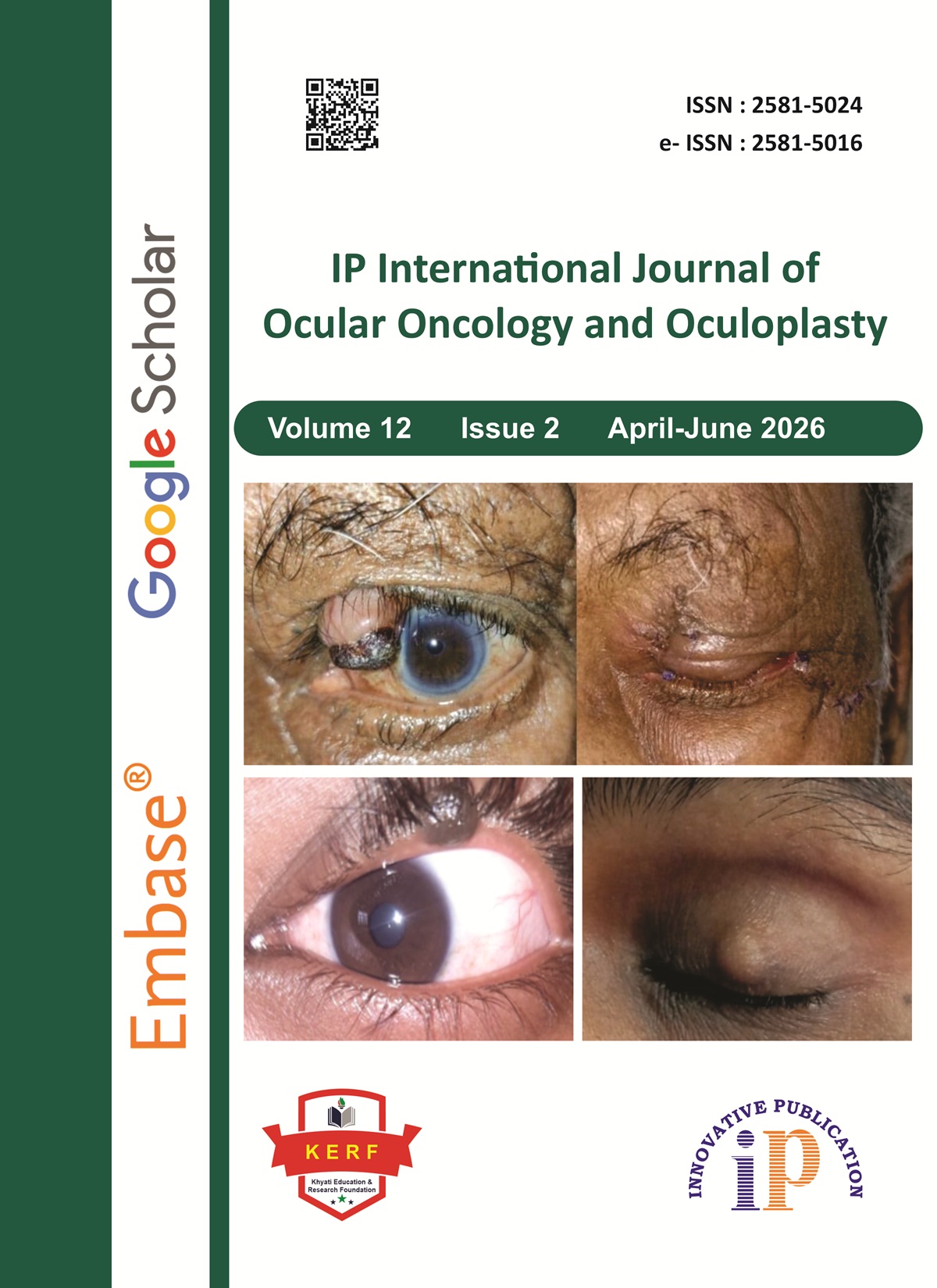IP International Journal of Ocular Oncology and Oculoplasty
